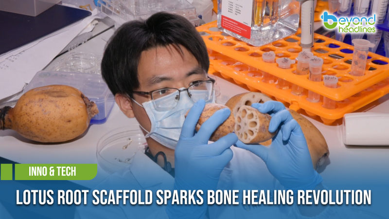 [Inno & Tech] Lotus Root-Inspired Material Shows Promise in Bone Repair Breakthrough
