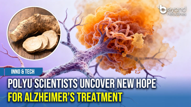 [Inno & Tech] PolyU Scientists Uncover New Hope for Alzheimer’s Treatment