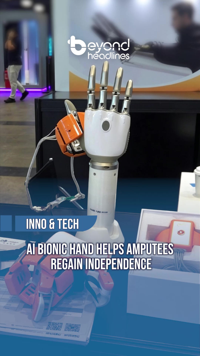 [Inno & Tech] AI Bionic Hand Helps Amputees Regain Independence