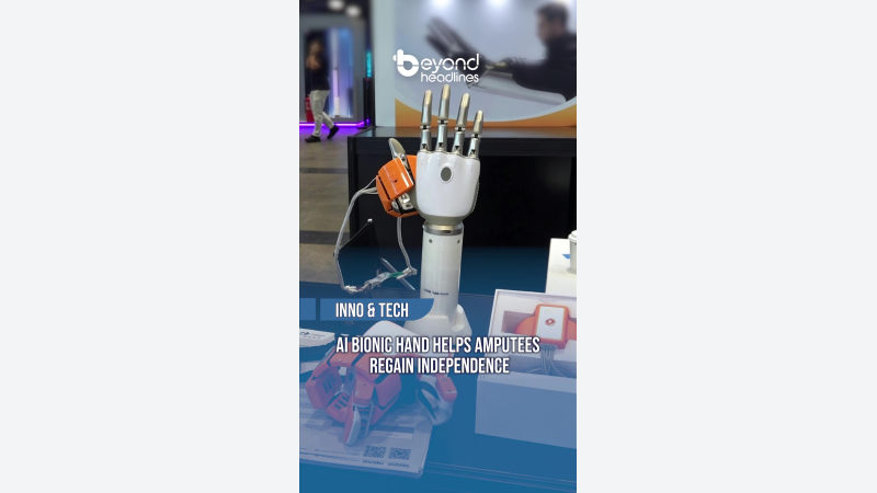 [Inno & Tech] AI Bionic Hand Helps Amputees Regain Independence